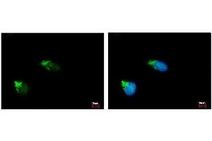 ICC/IF Image GALNT2 antibody [N1C1] detects GALNT2 protein at Golgi apparatus by immunofluorescent analysis. (GALNT2 anticorps)