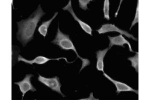 Immunofluorescent staining of HeLa (ATCC CCL-2) cells.