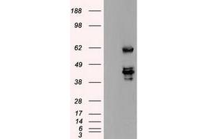 HEK293T cells were transfected with the pCMV6-ENTRY control (Left lane) or pCMV6-ENTRY SSB (Right lane) cDNA for 48 hrs and lysed. (SSB anticorps)
