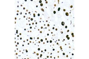 Immunohistochemistry of paraffin-embedded human liver using HNRNPM Rabbit mAb (ABIN7267635) at dilution of 1:100 (40x lens).
