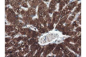 Immunohistochemistry (IHC) image for anti-Cytochrome P450, Family 2, Subfamily A, Polypeptide 6 (CYP2A6) antibody (ABIN1497723) (CYP2A6 anticorps)