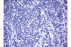 Image no. 2 for anti-Mdm2, p53 E3 Ubiquitin Protein Ligase Homolog (Mouse) (MDM2) (AA 119-438) antibody (ABIN1490872)