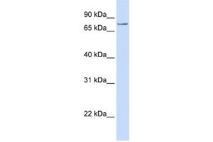 WB Suggested Anti-SYDE1  Antibody Titration: 0. (SYDE1 anticorps  (C-Term))