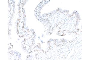 Immunohistochemistry (IHC) image for anti-Paired Box 8 (PAX8) (AA 225-275) antibody (ABIN7795777) (Recombinant PAX8 anticorps  (AA 225-275))