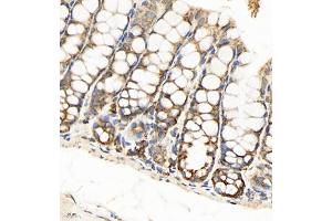 Immunohistochemistry of paraffin embedded mouse colon using SEC238 (ABIN7075521) at dilution of 1:650 (400x lens) (Sec23 Homolog B anticorps)