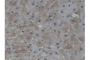 IHC-P analysis of Pig Cardiac Muscle Tissue, with DAB staining. (CKM anticorps  (AA 11-367))