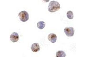 Immunocytochemistry of CARD8 in K562 cells with AP30184PU-N CARD8 antibody at 10 μg/ml.