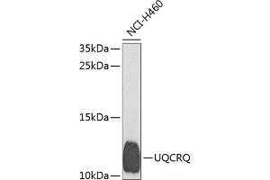 Western blot analysis of extracts of H460 cells using UQCRQ Polyclonal Antibody at dilution of 1:1000. (UQCRQ anticorps)