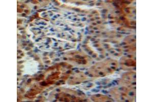 Used in DAB staining on fromalin fixed paraffin-embedded kidney tissue