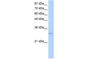 EXOSC6 antibody used at 5 ug/ml to detect target protein. (EXOSC6 anticorps  (N-Term))