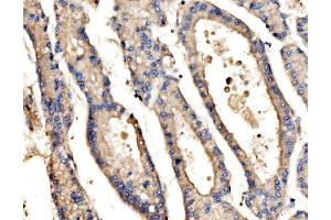 IHC analysis of SRP72 using anti-SRP72 antibody (ABIN7601648).