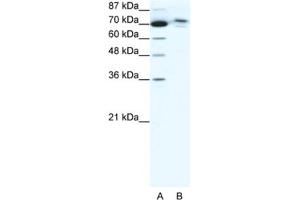 Western Blotting (WB) image for anti-Chromosome 14 Open Reading Frame 101 (C14orf101) antibody (ABIN2460921) (C14orf101 anticorps)