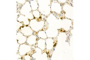Immunohistochemistry analysis of paraffin embedded rat lung using S100A9 (ABIN7075497) at dilution of 1: 1800
