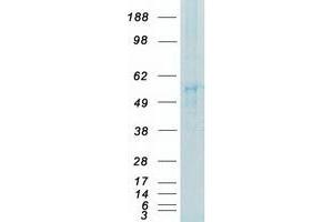 Validation with Western Blot
