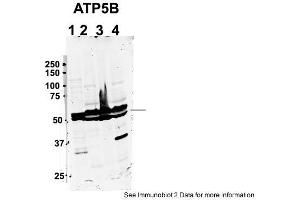 Sample Type: 1. (ATP5B anticorps  (C-Term))