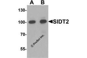 Western Blotting (WB) image for anti-SID1 Transmembrane Family, Member 2 (SIDT2) (N-Term) antibody (ABIN1077417) (SIDT2 anticorps  (N-Term))