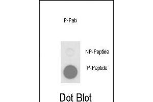 Dot blot analysis of anti-Phospho-PLB-T17 Phospho-specific Pab (ABIN650834 and ABIN2839801) on nitrocellulose membrane. (Phospholamban anticorps  (pThr17))