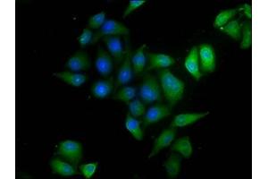Immunofluorescence staining of Hela cells with ABIN7144576 at 1:120,counter-stained with DAPI.