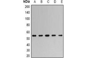 Western blot analysis of TRAF2 expression in HeLa (A), PC12 (B), Romas (C), Jurkat (D), NIH3T3 (E) whole cell lysates. (TRAF2 anticorps)