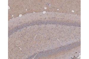 IHC analysis of Tau/MAPT using anti-Tau/MAPT antibody (ABIN7599268). (MAPT anticorps  (AA 1-322))