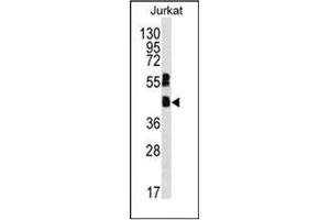 Western blot analysis of MAFB Antibody (C-term) in Jurkat cell line lysates (35ug/lane). (MAFB anticorps  (C-Term))