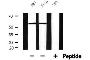 Western blot analysis of extracts from 293 and Hela, using Cytochrome P450 17A1 Antibody. (CYP17A1 anticorps  (Internal Region))