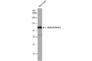 WB Image alpha Actinin 2 antibody detects alpha Actinin 2 protein by western blot analysis. (ACTN2 anticorps)