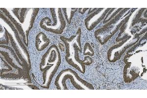 IHC analysis of PARP using anti-PARP antibody (ABIN7602278). (PARP1 anticorps  (AA 670-858))