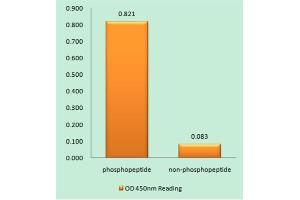 Immunohistochemistry analysis of paraffin-embedded human brain tissue using NMDAR1 (Phospho-Ser890) antibody. (GRIN1/NMDAR1 anticorps  (pSer890))