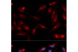 Immunofluorescence analysis of U2OS cells using ADAM9 Polyclonal Antibody (ADAM9 anticorps)