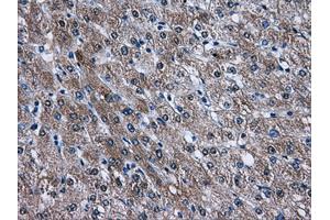 Immunohistochemical staining of paraffin-embedded liver tissue using anti-AKT2mouse monoclonal antibody. (AKT2 anticorps)