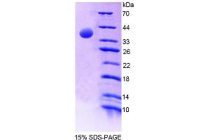 SDS-PAGE analysis of Human EPB41 Protein. (EPB41 Protéine)