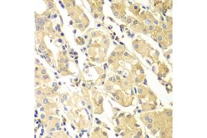 Immunohistochemistry of paraffin-embedded human gastric using PDCD2L antibody (ABIN4904708) at dilution of 1:100 (40x lens).