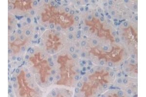 DAB staining on IHC-P; Samples: Rat Kidney Tissue (ICOS anticorps  (AA 39-133))