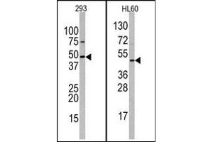 Image no. 1 for anti-Suppressor of Variegation 3-9 Homolog 2 (Drosophila) (SUV39H2) (C-Term) antibody (ABIN356791) (SUV39H2 anticorps  (C-Term))