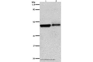 Western blot analysis of Hela and A549 cell, using ADRB2 Polyclonal Antibody at dilution of 1:600 (beta 2 Adrenergic Receptor anticorps)