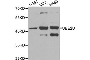 Western blot analysis of extracts of various cell lines, using UBE2U antibody (ABIN5974574) at 1/1000 dilution. (UBE2U anticorps)