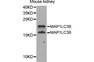 Western blot analysis of extracts of mouse kidney, using MAP1LC3B antibody (ABIN5973262) at 1/1000 dilution. (LC3B anticorps)