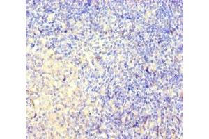 Immunohistochemistry of paraffin-embedded human pancreatic tissue using ABIN7148826 at dilution of 1:100 (CNGA4 anticorps  (AA 1-575))