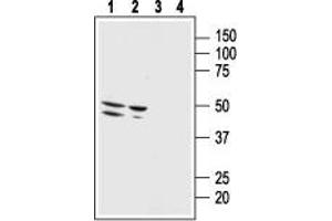 Western blot analysis of human malignant melanoma cell line Malme-3M (lanes 1 and 3) and human normal skin fibroblast cell line Malme-3 (lanes 2 and 4): - 1,2. (Bombesin Receptor 3 anticorps  (2nd Extracellular Loop))