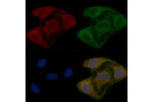 NIPSNAP1 Mouse Monoclonal Antibody staining Hela cells by IF/ICC. (NIPSNAP1 anticorps)