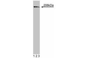 Western blot analysis of GBF1 on a HeLa cell lysate (Human cervical epitheloid carcinoma, ATCC CCL-2. (GBF1 anticorps  (AA 1266-1379))