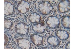 Detection of Cys-C in Human Intestine Tissue using Polyclonal Antibody to Cystatin C (Cys-C) (Cystathionine-gamma-Synthase Precursor (CYS) (AA 27-146) anticorps)