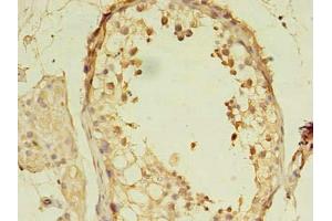 Immunohistochemistry of paraffin-embedded human testis tissue using ABIN7160198 at dilution of 1:100 (MORC2 anticorps  (AA 2-300))