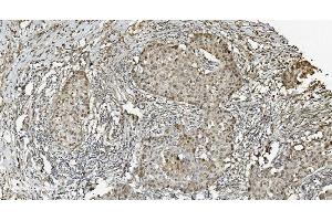 IHC analysis of MCM5 using anti-MCM5 antibody (ABIN7600583). (MCM5 anticorps  (AA 206-723))