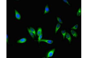 Immunofluorescent analysis of Hela cells using ABIN7170721 at dilution of 1:100 and Alexa Fluor 488-congugated AffiniPure Goat Anti-Rabbit IgG(H+L)