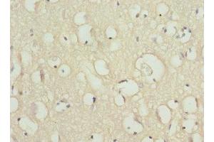 Immunohistochemistry of paraffin-embedded human brain tissue using ABIN7169937 at dilution of 1:100