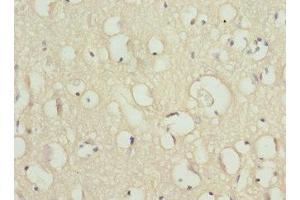 Immunohistochemistry of paraffin-embedded human brain tissue using ABIN7169937 at dilution of 1:100 (SCN2B anticorps  (AA 30-160))
