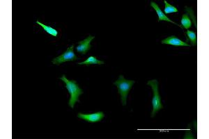 Immunofluorescence of purified MaxPab antibody to PRKAG2 on HeLa cell. (PRKAG2 anticorps  (AA 1-328))