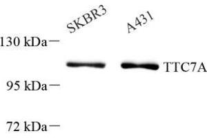 Western blot analysis of TTC7A (ABIN7075875) at dilution of 1: 1000 (TTC7A anticorps)
